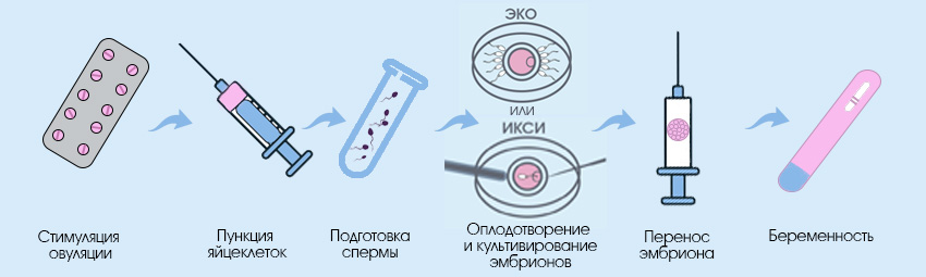 страница ЭКО для иногородних пациентов_2.jpg