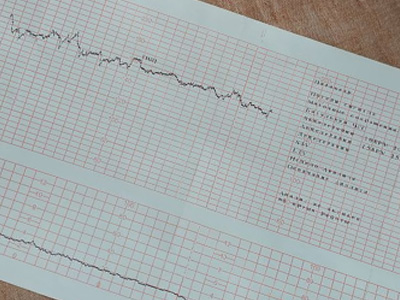 КТГ плода при беременности